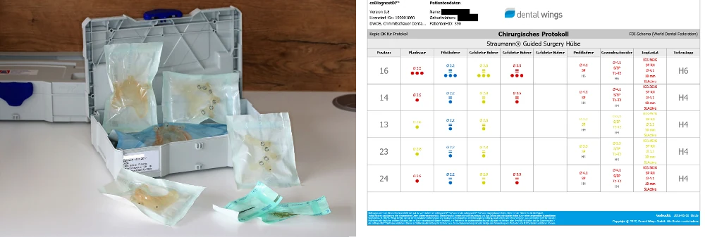 Links die steril verpackten Schablonen, rechts ein chirurgisches Protokoll als Tabelle